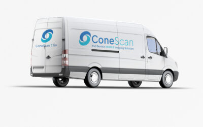 A blue-logoed van equipped for Mobile CBCT scanning.